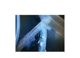 Mikrobes verhoog wortelgroei én opbrengs